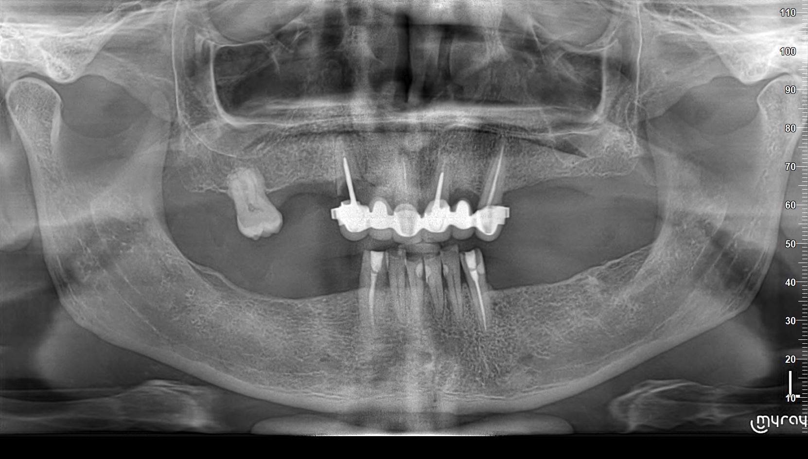 Case 2 Intraoral Before