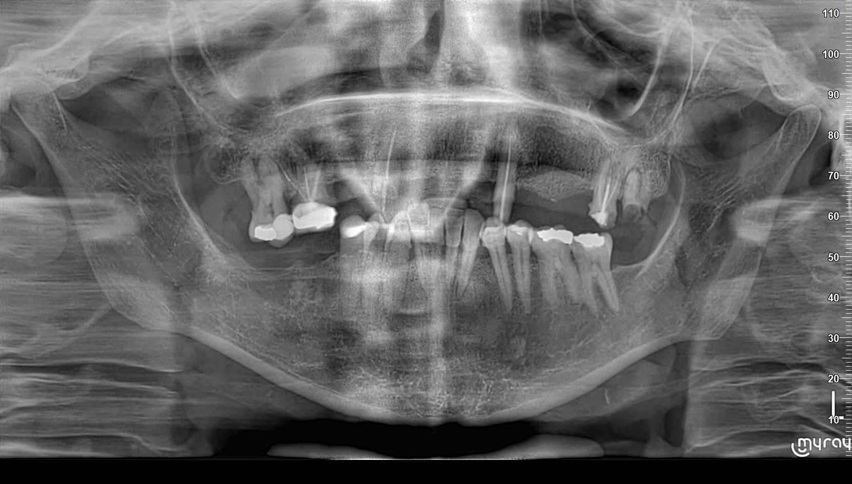 Case 3 Intraoral Before