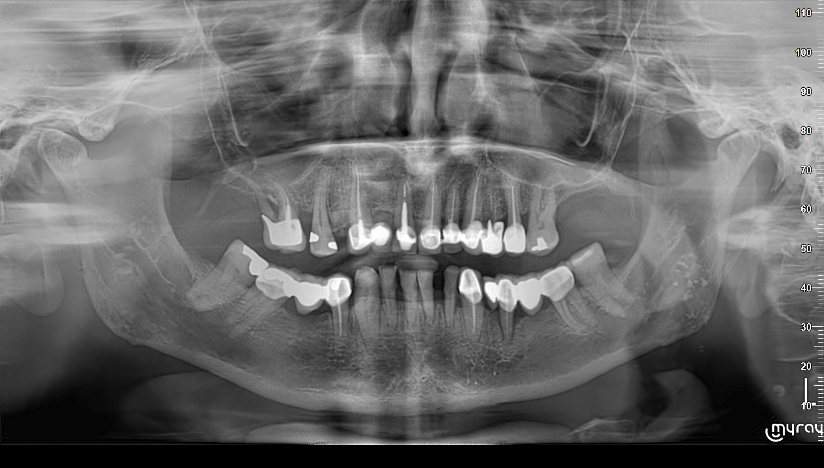Dental case 4 before treatment